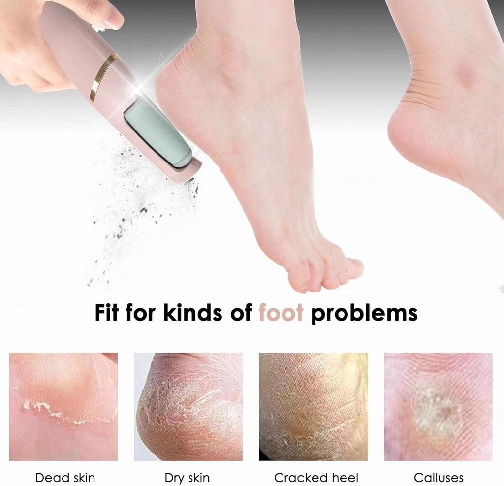 Electric Pedicure Foot File Callus Remover Rechargeable Foot Scrubber